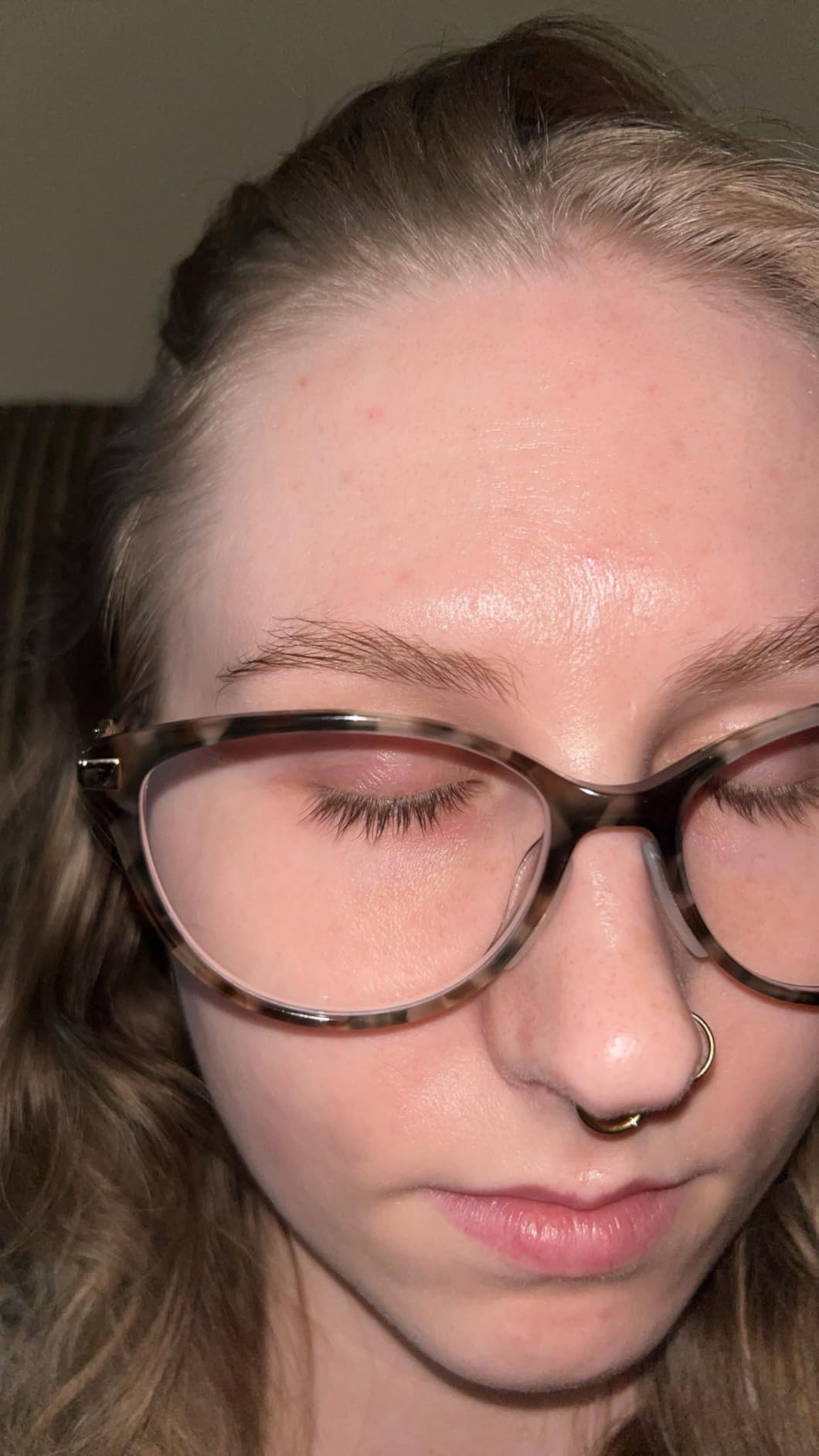 The Eye Aging Crisis: Why Specialized Care Matters