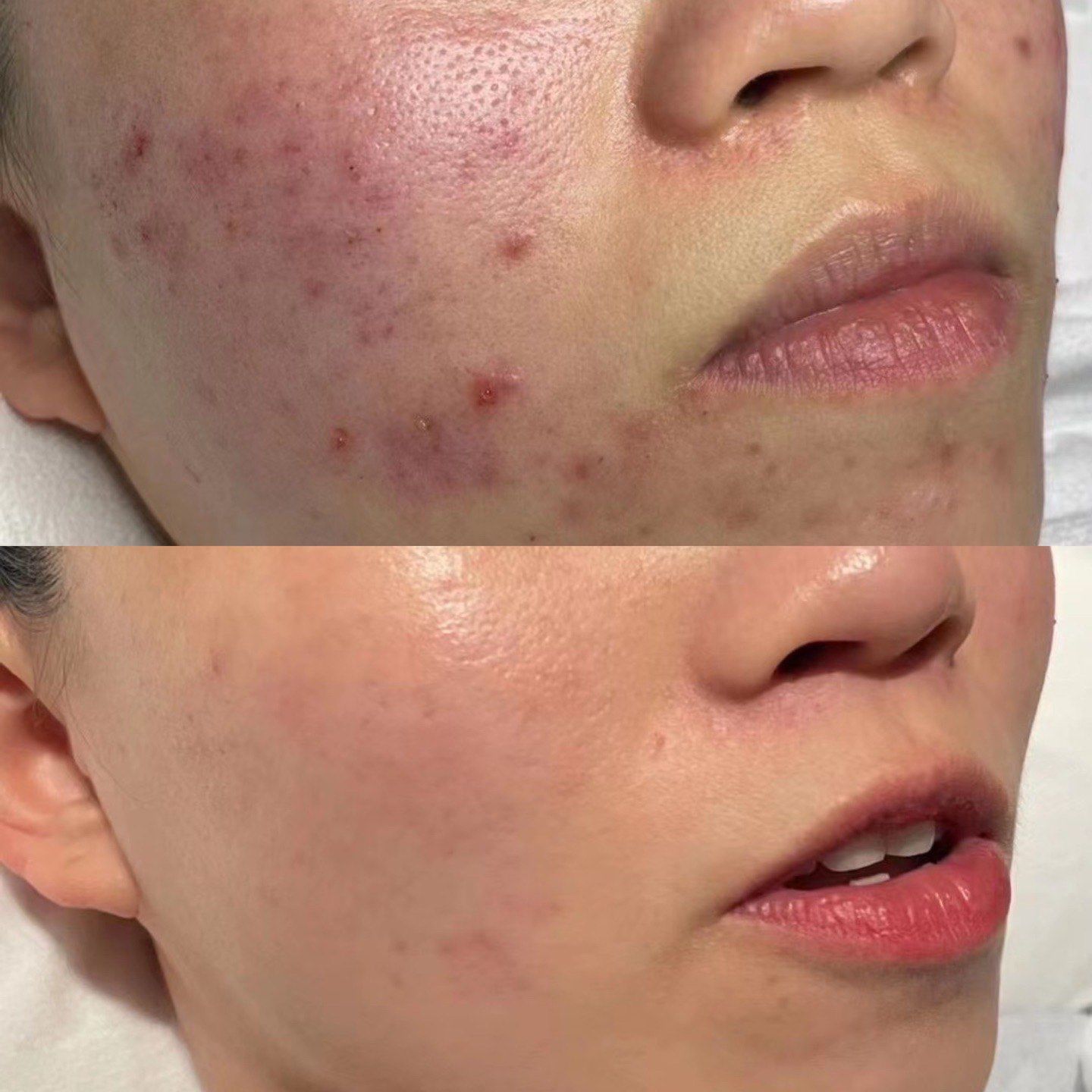 The Night My Skin Betrayed Me (And How I Fixed It Forever)